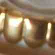 Dentier